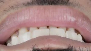 Clinical Case 1