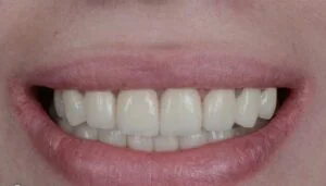 Clinical Case 10