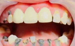 Clinical Case 11