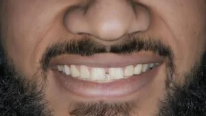 Clinical Case 13