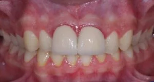 Clinical Case 17