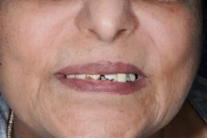 Clinical Case 19