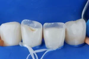 Clinical Case 21