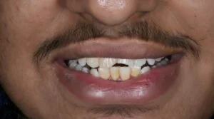 Clinical Case 24