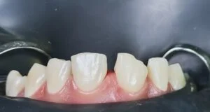 Clinical Case 26