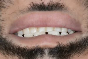 Clinical Case 27