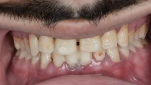 Clinical Case 28
