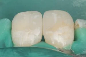 Clinical Case 3