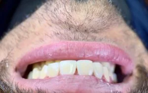 Clinical Case 30