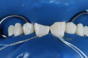 Clinical Case 32