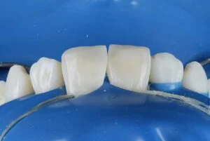 Clinical Case 33