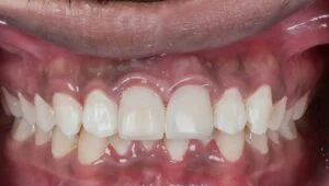 Clinical Case 34