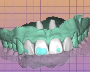 Clinical Case 37