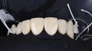 Clinical Case 38