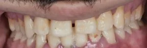 Clinical Case 39