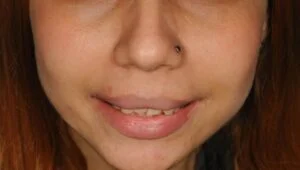Clinical Case 40