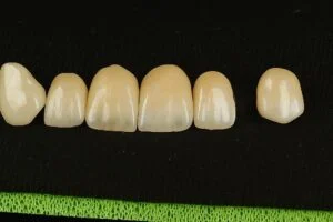 Clinical Case 41