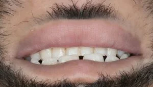 Clinical Case 42
