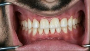 Clinical Case 45
