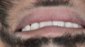 Clinical Case 47