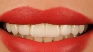Clinical Case 49