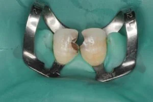 Clinical Case 5