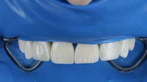 Clinical Case 52