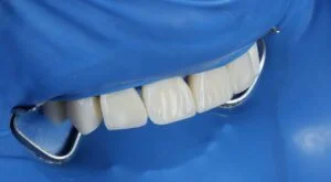 Clinical Case 54