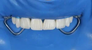 Clinical Case 55