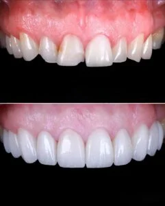 Clinical Case 57