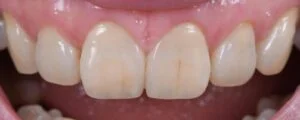 Clinical Case 62