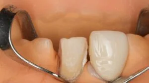 Clinical Case 66