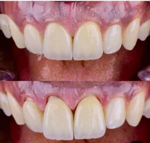 Clinical Case 67