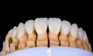 Clinical Case 68