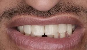 Clinical Case 70