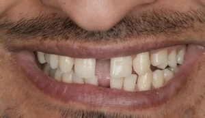 Clinical Case 711
