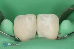 Clinical Case 721