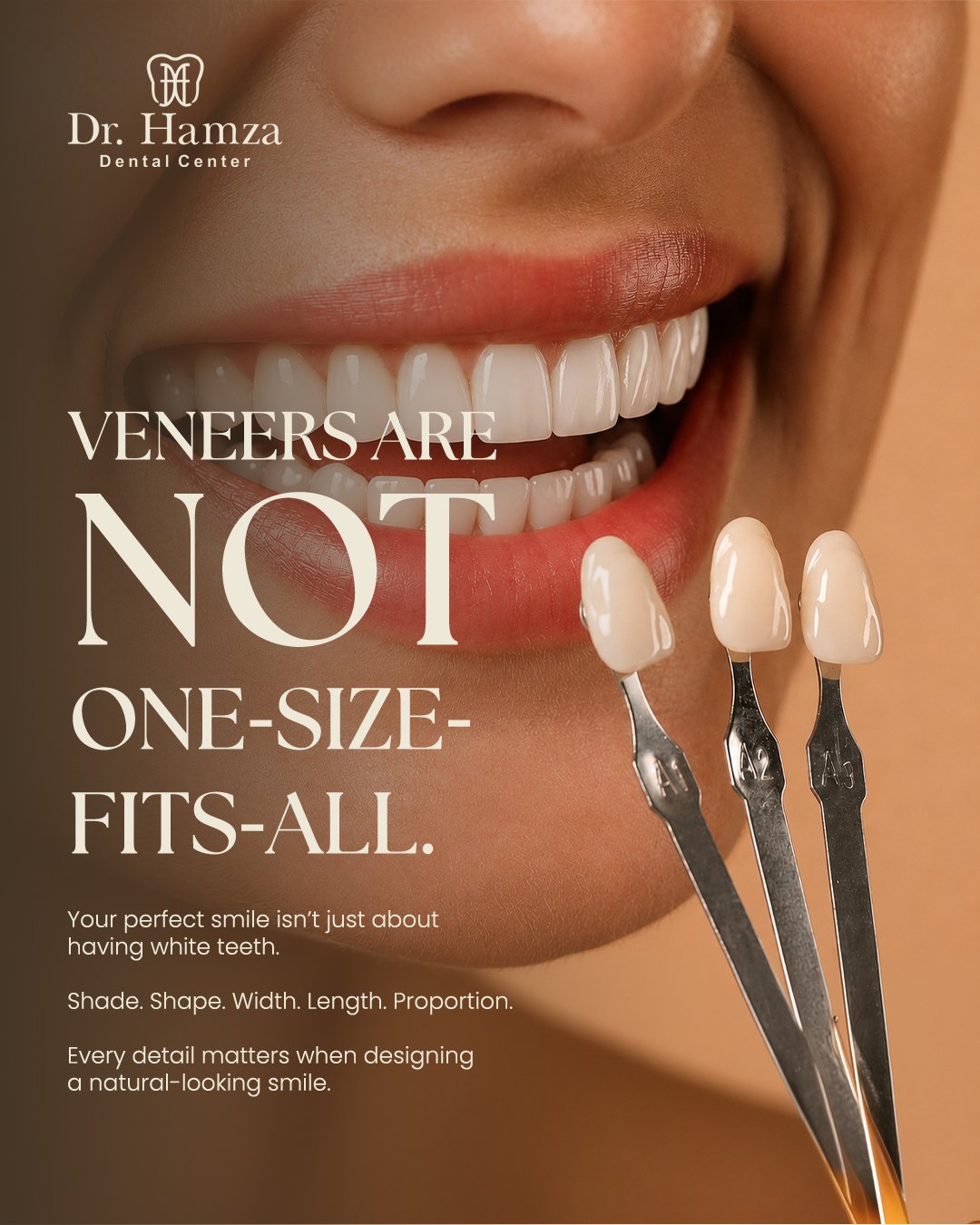 Veneers Offer 1