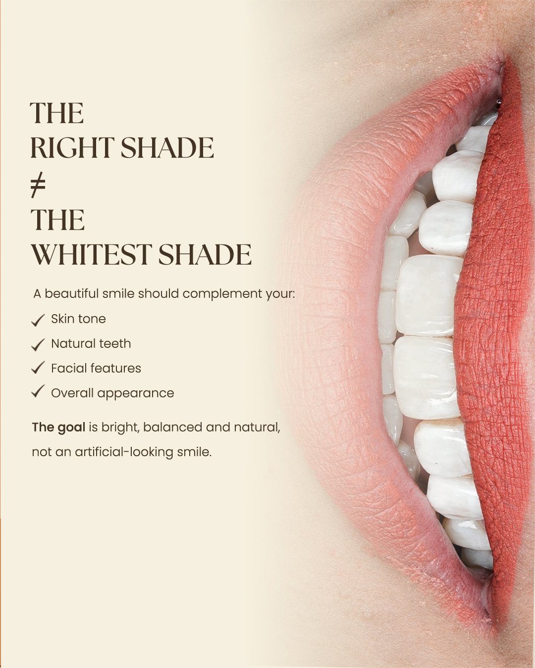 Veneers Offer 2